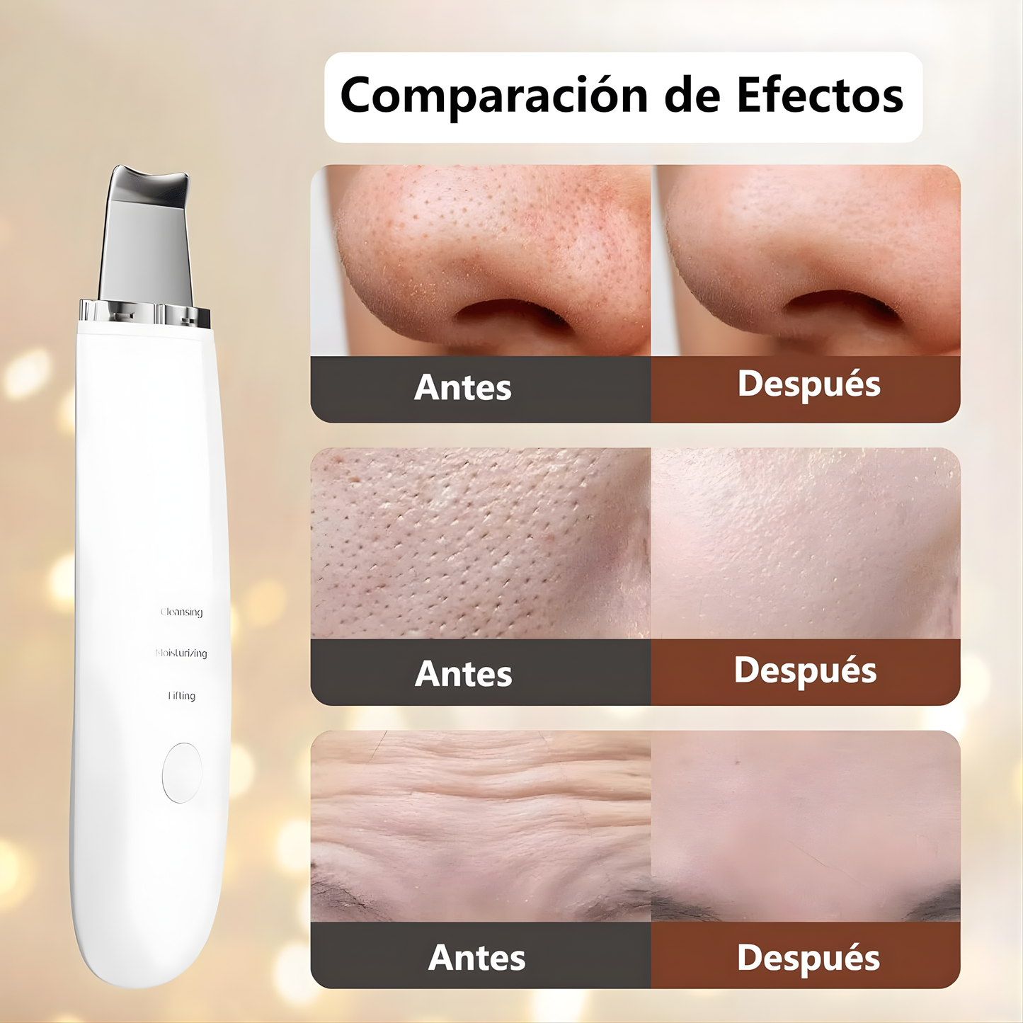 Limpiador facial de espatula para puntos negros